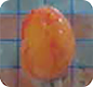Centrifuged Fat